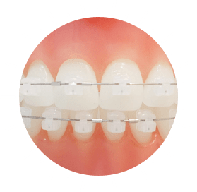 grosse pointe farms orthodontics