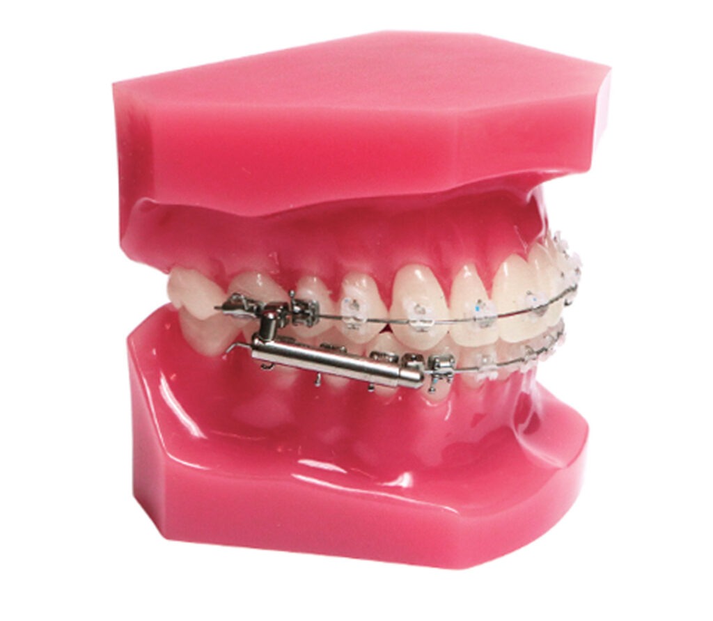 orthodontist grosse pointe