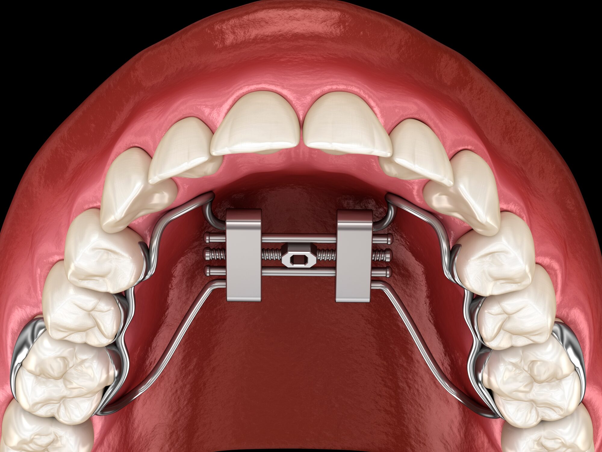 orthodontist grosse pointe