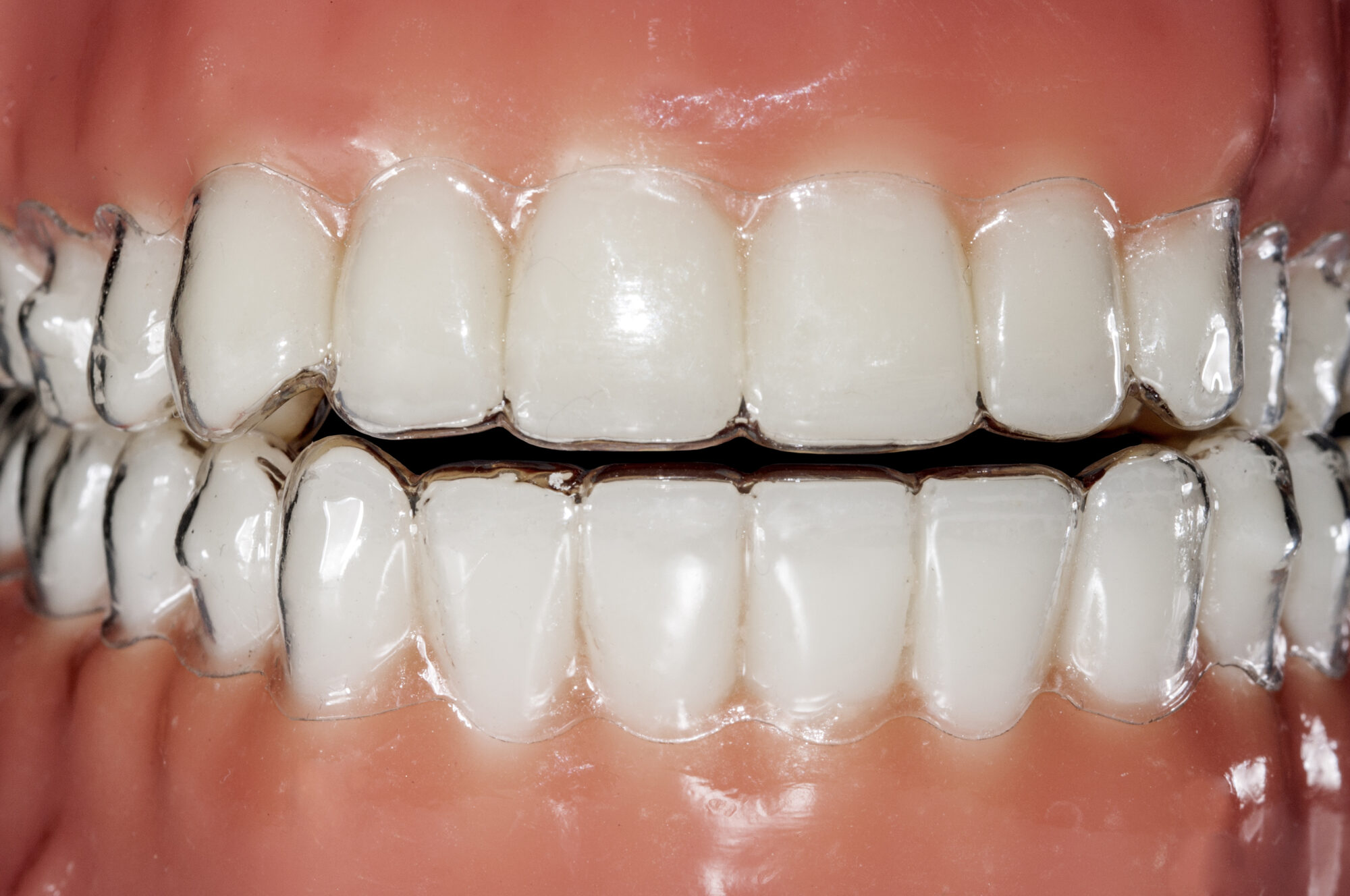 grosse pointe orthodontics